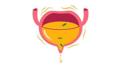 Urinary tract infection illustration animation 
