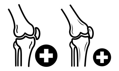 Illustration of knee joint with positive sign, representing orthopedic health and medical care