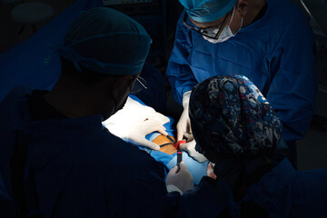 Surgeons performing abdominal procedure with sterile instruments