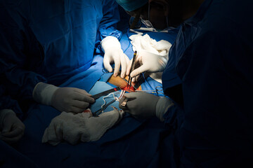 Surgeons performing abdominal procedure with sterile instruments
