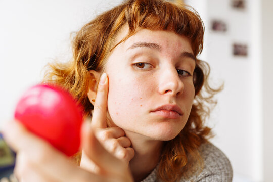 young woman looks at problematic facial skin in mirror