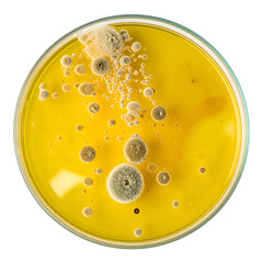 Petri dish showcasing various colorful fungal colonies on a yellow agar medium