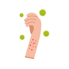 Illustration Of Hand With Measles