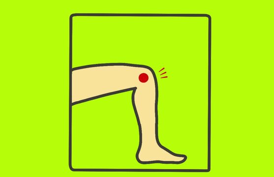 animation of sore and painful legs on a green background