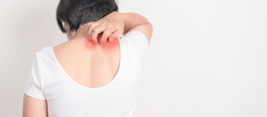 Elderly woman itching Neck and body scratching for Skin Allergy from insect bite and food...