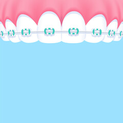 Upper teeth (Orthodontics) - Text box banner (square) illustration vector design. Dental care concept.