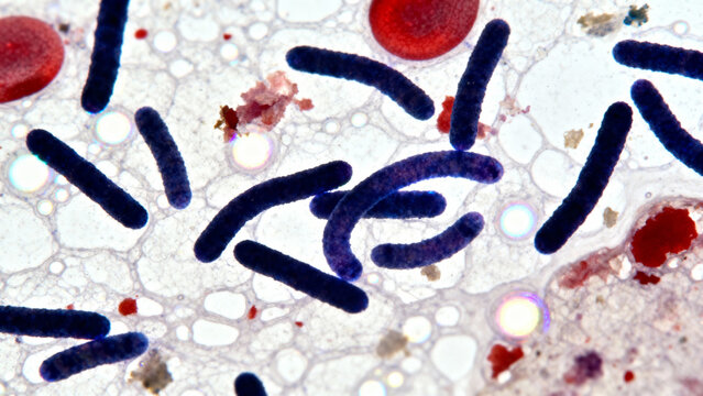 A micrograph of Bartonella henselae, the causative agent of cat scratch disease, showing numerous small, Gram-negative, rod-shaped Bartonella henselae bacteria. 