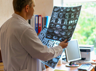 Doctor holding and examining MRI or CT scan images with human organs in light. Concept of medical diagnostics, radiology, examination and health research.