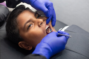 Revisión de dientes en estudio 