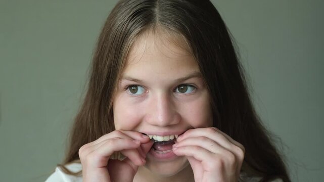 Teenage girl puts on orthodontic apparatus for correcting the upper jaw, and smiling. Device for dental treatment. Teeth correction, gnathology concept