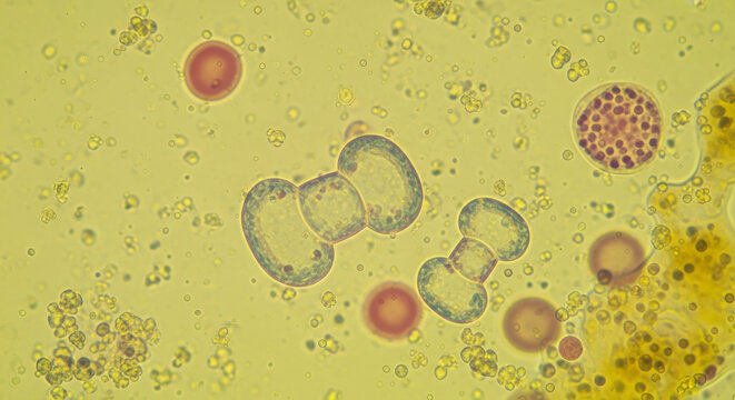 Microscopic view of yeast cells and other biological material