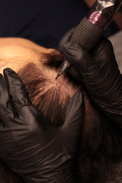 Close-up image showing a professional scalp micropigmentation (SMP) procedure in progress. A trained technician uses a specialized microneedle tool to apply pigment to a client's scalp