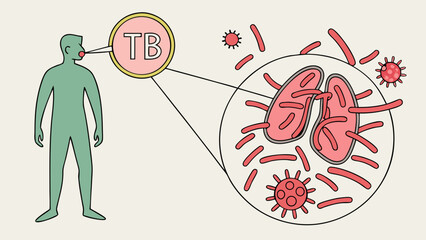 Infectious Disease Illustration Respiratory System and Bacteria Transmission Vector Graphic.