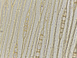 Microscopic view of elongated cells