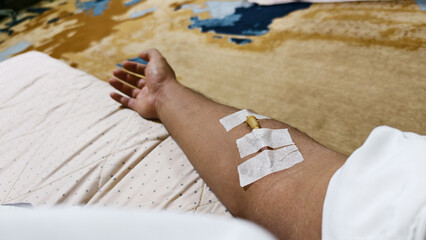 Close Up Shot of Hand of Male Blood Donor With an Attached Catheter. blood donation