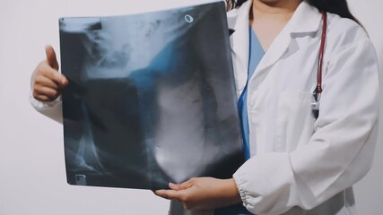 Doctor examining chest x-ray film of patient at hospital. - Powered by Adobe