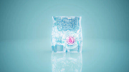 Conceptual 3D illustration of a human hernia