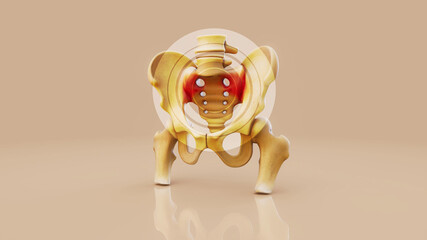 Conceptual 3D illustration of a sacroiliac joint inflammation