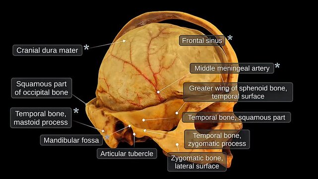 Lateral view of human skull and meninges