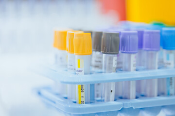Vacutainer, blood collection tubes for hospital, healthcare, medicine science lab for background
