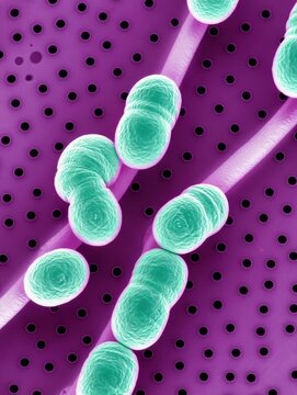 Electron microscopy of Streptococcus pneumoniae cells for laboratory diagnostics