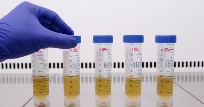 The scientist places a large test tube with yellow liquid in a row of test tubes on the work table.