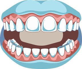 ChatGPT сказал:

A detailed cartoon-style dental illustration showing an open mouth with teeth and gums, highlighting oral anatomy and tooth alignment in a clean, educational vector design.