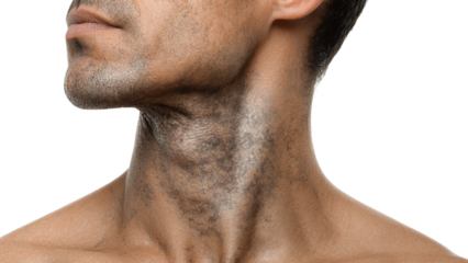 PNG of Close-up of a male model with a rugged, textured neck, showcasing strong jawline and subtle beard stubble.