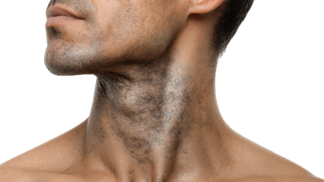 PNG of Close-up of a male model with a rugged, textured neck, showcasing strong jawline and subtle beard stubble.