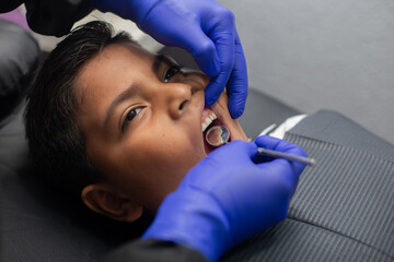 dental cleaning for a minor