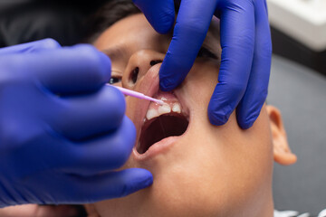 dental cleaning for a minor
