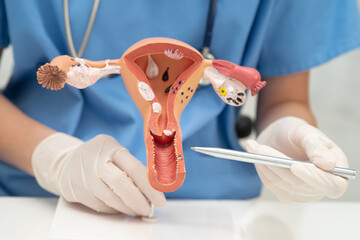 Uterus, doctor holding human anatomy model for study diagnosis and treatment in hospital.