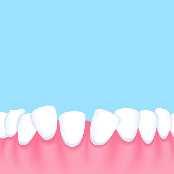Lower teeth (Crooked) - Text box sign blank banner (square) illustration vector design. Dental care concept.