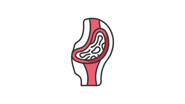 Medical illustration showcasing the anatomy of an artificial joint