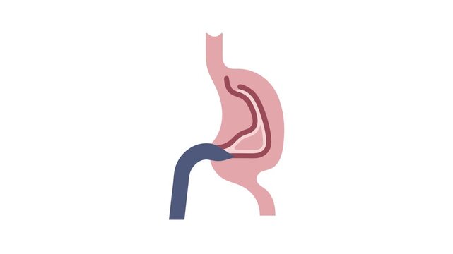 Anatomical vector illustration of human stomach on white background