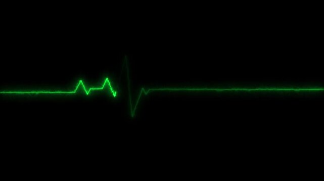 Glowing neon heartbeat and pulse rate animation. EKG monitoring in an emergency. Loop able medical heartbeat signal animation. Ideal for healthcare apps, cardiology infographics. 4k