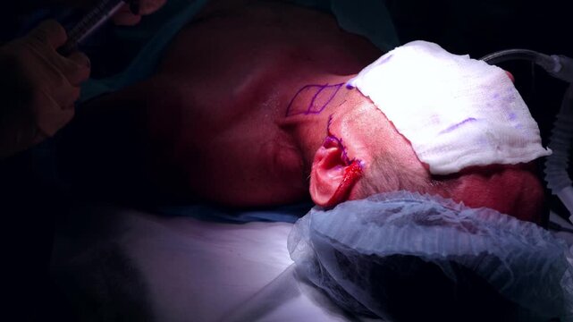 Surgeon administering local anesthetic prepares for neck surgery in a sterile operating room, prioritizing patient safety and comfort throughout the procedure