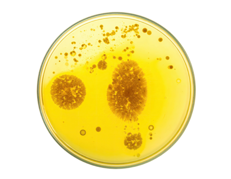 Petri dish with colonies of microorganisms