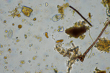 Tardigrade and soil fungal hyphae fungi microorganisms in a soil sample on a farm