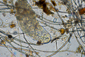 Tardigrade and soil fungal hyphae fungi microorganisms in a soil sample on a farm