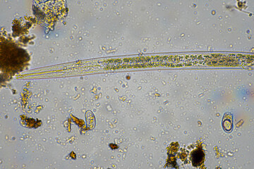 tardigrade soil microorganisms including nematode, and rotifers a soil sample, soil fungus and bacteria on a regenerative farm in compost under the microscope.