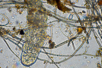 tardigrade soil microorganisms including nematode, and rotifers a soil sample, soil fungus and bacteria on a regenerative farm in compost under the microscope.