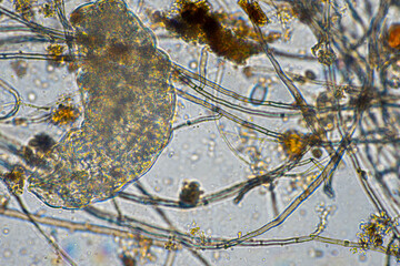 tardigrade soil microorganisms including nematode, and rotifers a soil sample, soil fungus and bacteria on a regenerative farm in compost under the microscope.