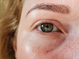 Fototapeta premium Detailed close-up of an eye with visible burst capillaries and skin textures. natural imperfections. High quality photo