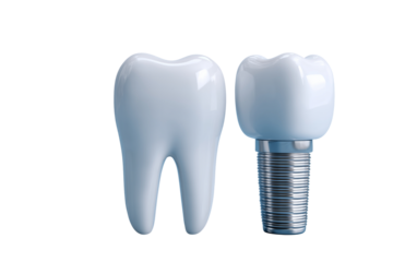 Dental implants and a healthy tooth model displayed on a blue background in a dental office setting Generative AI