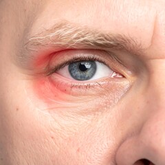 Obraz premium Close-up of red eye
