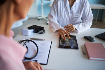Middle aged Caucasian woman sitting across from young adult Caucasian female doctor, reviewing chest X ray image on digital tablet, during cancer consultation in medical office