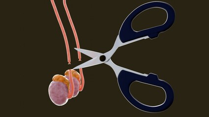 A 3d medical illustration image of a vasectomy. It shows of scissors cutting off the vas deferens tubes (the thin orange-red tubes that carry sperm).