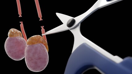 A 3d medical illustration image of a vasectomy. It shows of scissors cutting off the vas deferens tubes (the thin orange-red tubes that carry sperm).