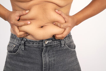 Obese man with big bellies and excess fat must control their diet.